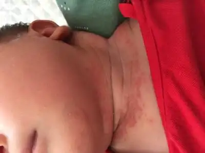 问答 婴儿期0-1岁 宝宝树孕育 90%的妈妈正在使用 宝宝树孕育 90%的