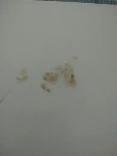 之前很少吐这种痰最近比较频繁,吐出来感觉呼吸很顺畅,本人吸烟最早吐