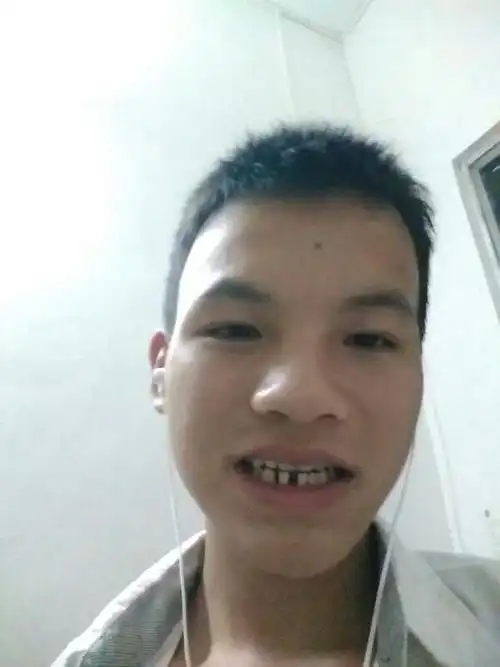 这人,长得怎么样, 按严重来讲,这个家伙就是个丑男,挫男, 垃圾人,牙齿