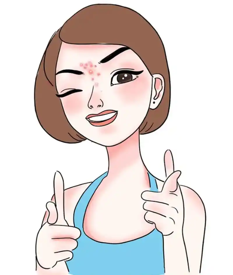 皮脂腺分泌过多皮脂和角质堵塞导致的,病变部位容易感染而形成的痘痘