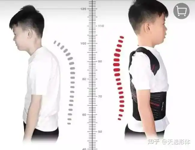 驼背低龄化倾向明显家长勿轻视孩子的体态问题