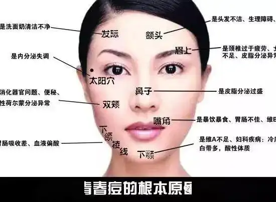 一,痘痘长在哪?病根就在哪儿!