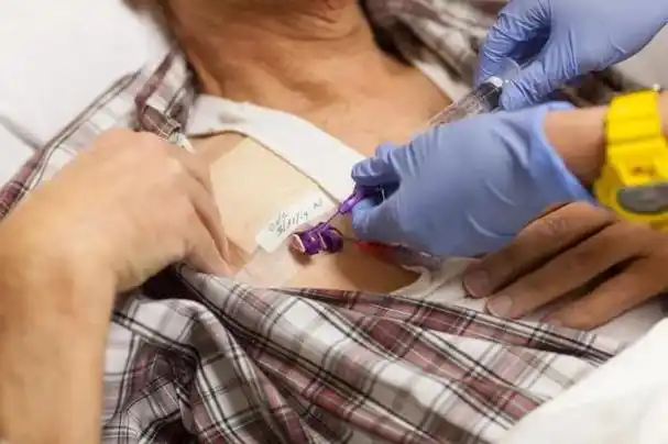 癌症化疗后,怎么知道有没有效果?若有3种表现,值得祝贺