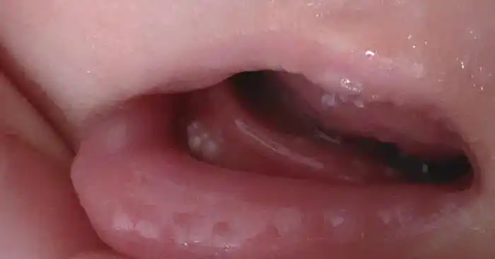 婴儿几个月长牙算正常(新生儿几个月长牙算正常)