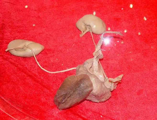 女性泌尿生殖系统标本