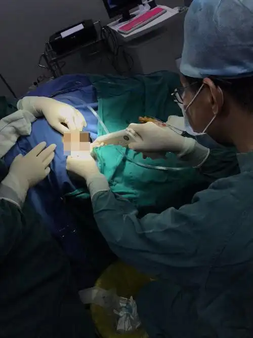 许瑞云主任来我院传授rph手术治疗痔疮技巧