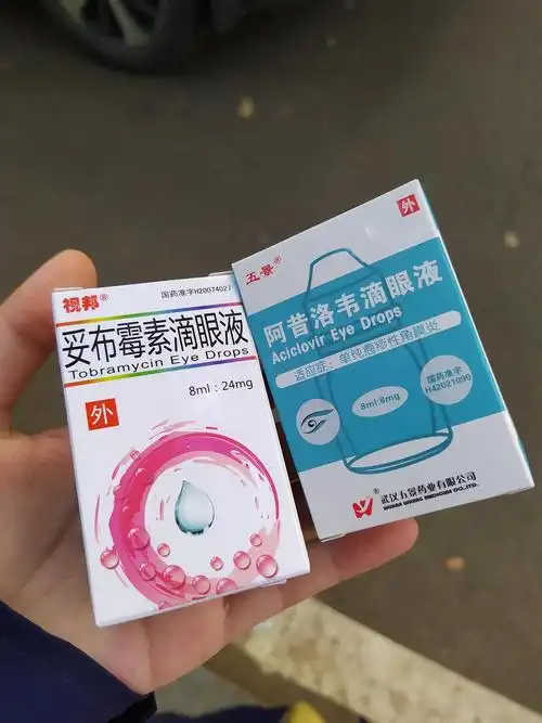 谢谢大家!已经去医院看了,开了点眼药水.