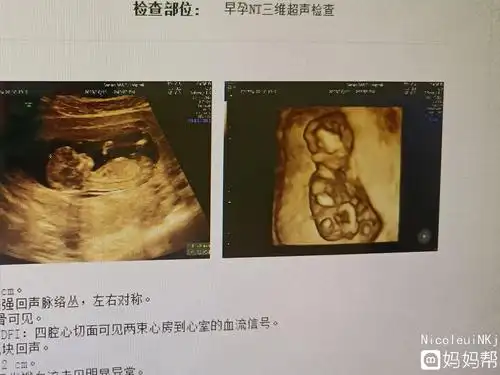 不乱收费!nt三个亮点是男孩女孩"备孕成功"-第1张图片-吉泽网