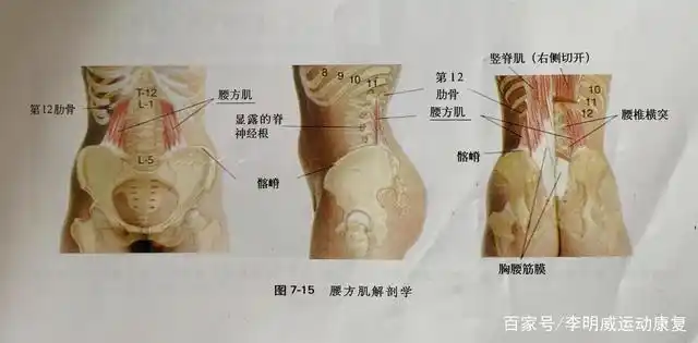 腰痛的元凶——腰方肌