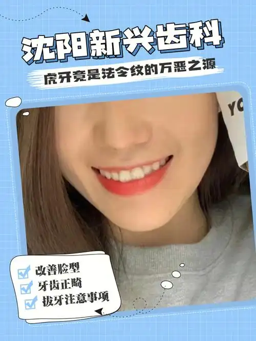 虎牙占了"一半的功劳"-虎牙是长在上颌门牙旁边的两颗尖牙,俗称"犬齿"