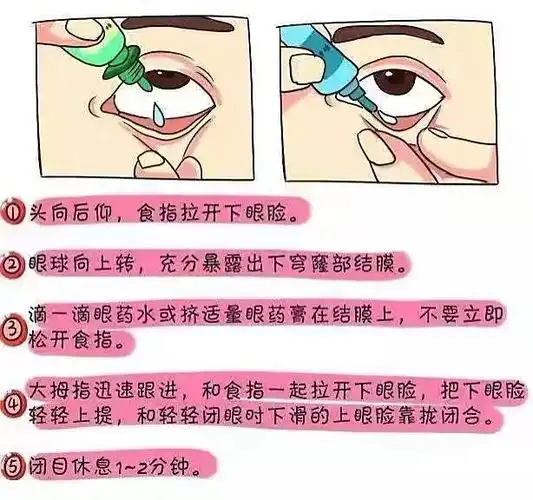 眼膏比滴眼液在结膜囊内保存的时间长,为长效制剂.