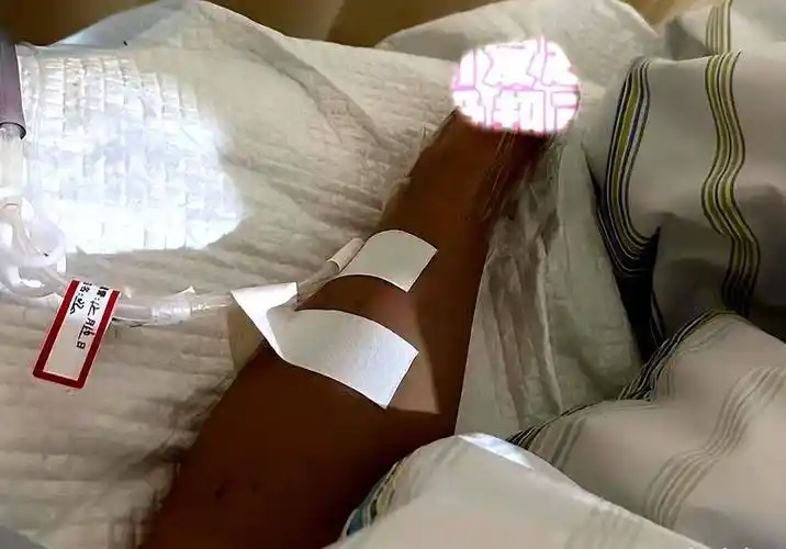 网红杜颜嘉出事故左手截肢,曾与洪金宝儿子传绯闻,评论区已沦陷_洪天