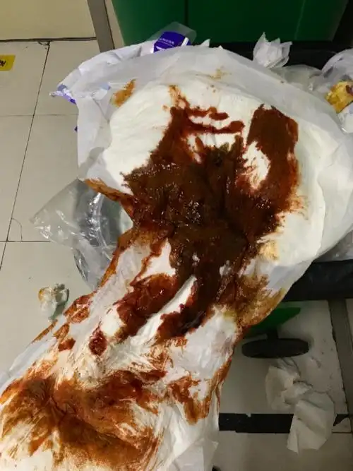 这是什么颜色的大便