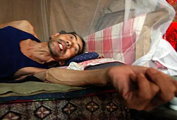 吃发物会让癌症复发患者该怎么避免发物