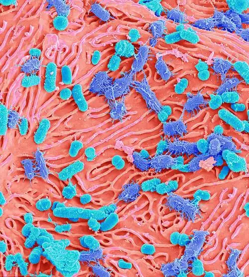 显微镜下的口腔细菌细长如海洋植物