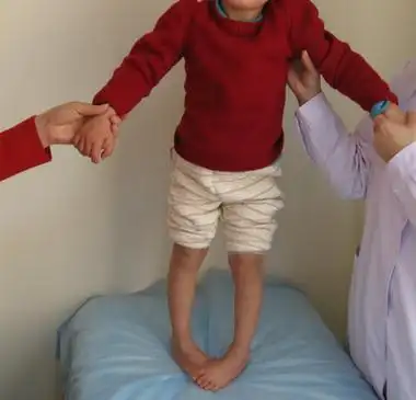 二个月脑瘫最典型症状婴儿总是腿蹬的颤抖 ( 二个月脑瘫最典型症状)