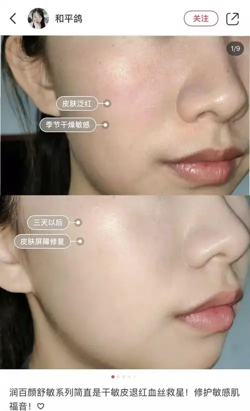 不到80元就能让你体验到水光针是什么感觉