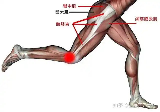 au/articles/iliotibial-band-syndrome/当髂胫束出现紧张时,会在膝盖