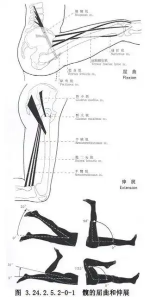 髂腰肌松解延长术