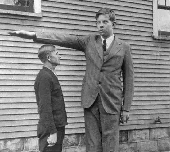 他前半生是身高1米22的侏儒后半生是2米16的巨人全球仅此一例