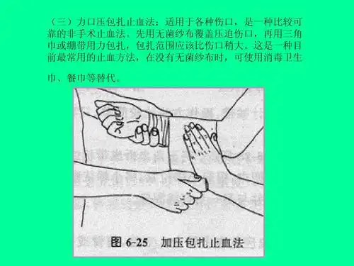 外伤急救技术——止血法 (三)力口压包扎止血法:适用于各种伤口,是一