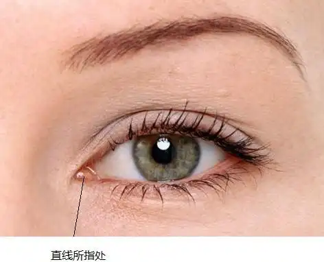 左眼眼角(靠近鼻翼这边)里面那个凸起的眼部组织叫什么?