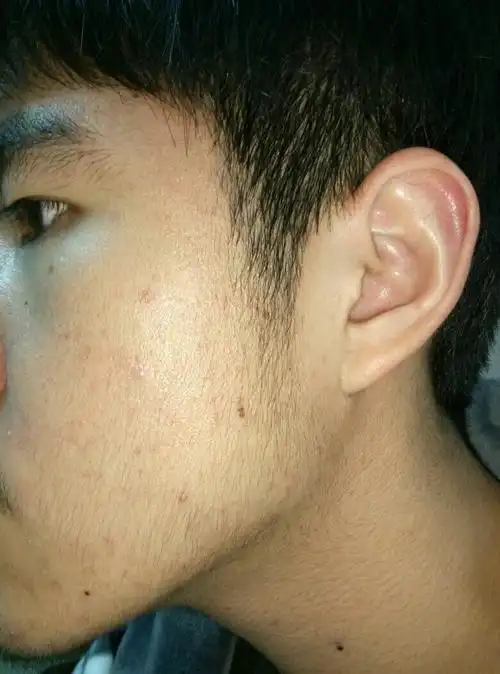 展开全部 越刮越粗  2 已赞过 已踩过   你对这个回答的评价是?