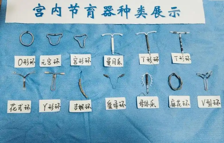 张好婆_手术_节育器
