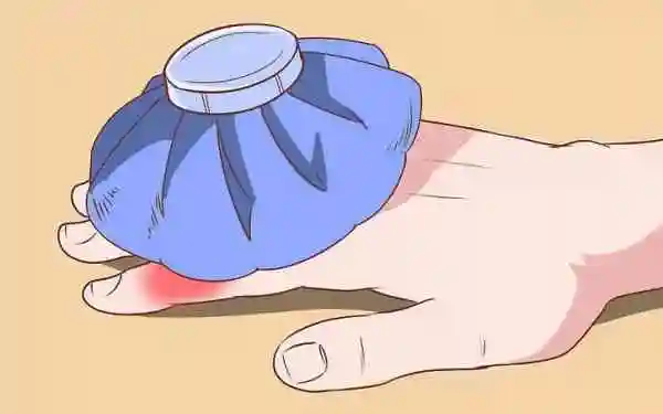 24小时后,应当该为热毛巾热敷;冷热敷每次都在15-20分钟.