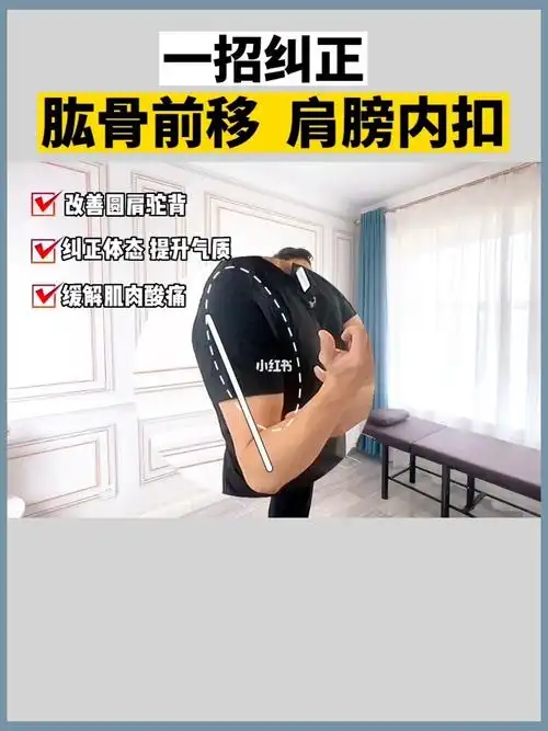 肱骨前移矫正分享75