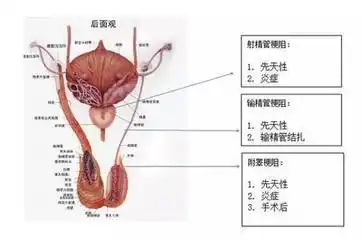 他的生精功能是正常的,之所以精液中没有精子就是因为输精管道阻塞了