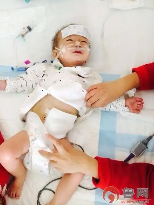 费县大肚男孩后记:手术已成功,后续治疗费用仍高昂