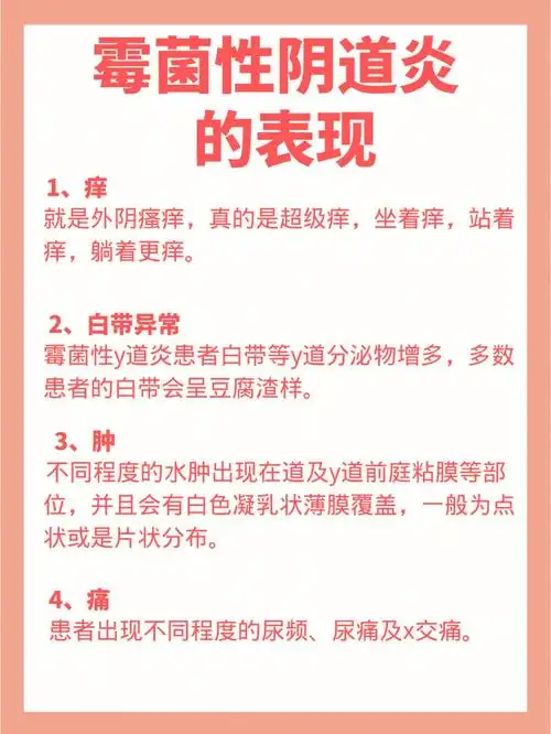 霉菌性阴道炎的症状表现诱因姐妹们码住