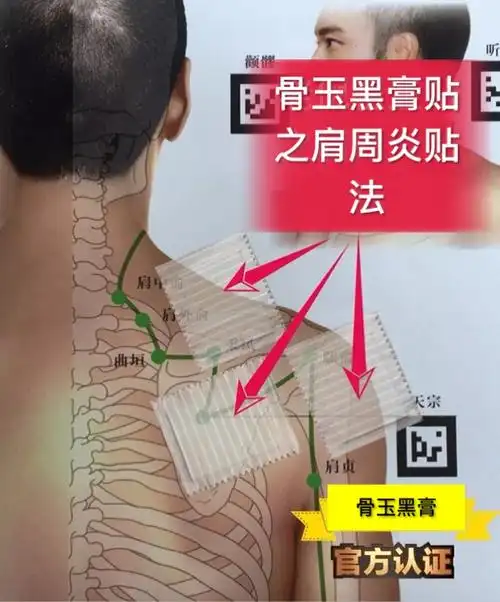 南京同仁堂(骨玉黑膏)贴之肩周炎贴法