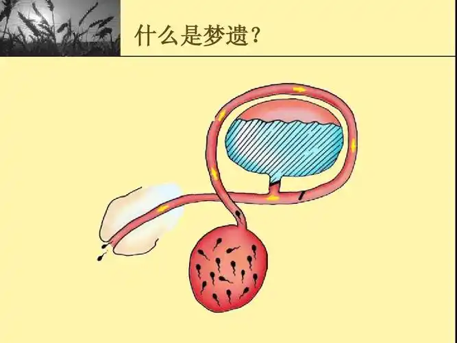 什么是梦遗?