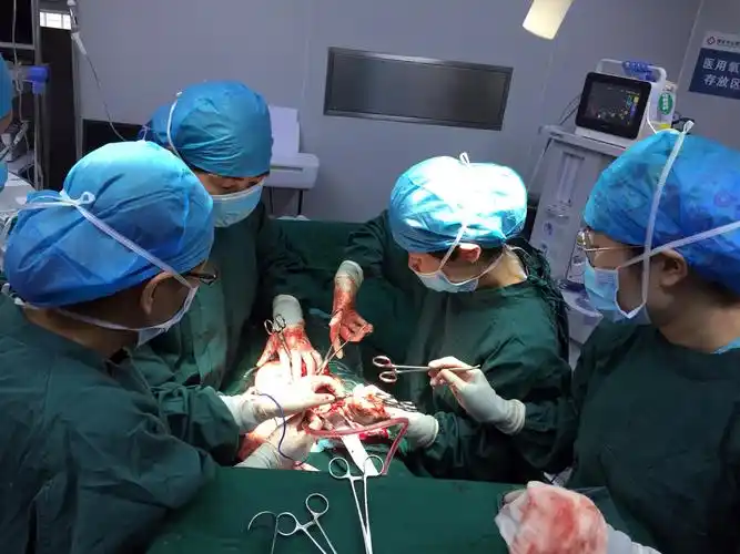 我院妇产科成功完成1例罕见巨大子宫肌瘤切除手术