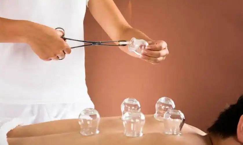 拔罐并不适合所有人想拔罐的人注意了