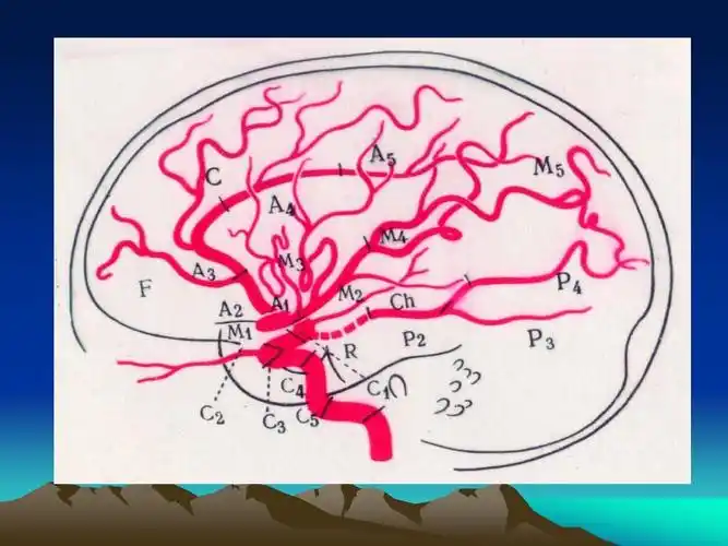 脑血管解剖与介入治疗ppt