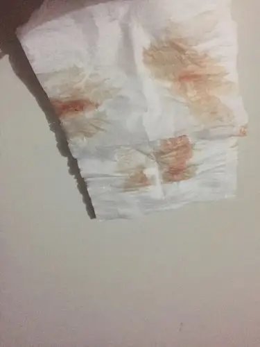 您好!为什么我跟男朋友同房第一次没有出血,后来三次都有呢?最