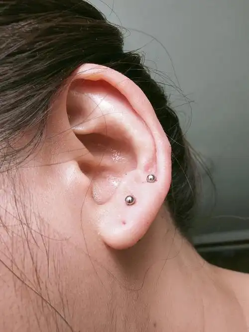 有图慎入 请问下打耳洞三天了 后面发紫