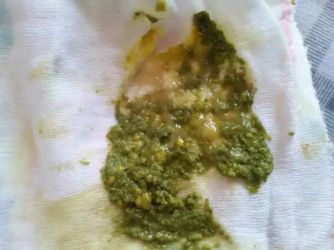 03-20 12:04    浏览  33333  推荐回答 赶紧去医院啊,这个是大便溏痢