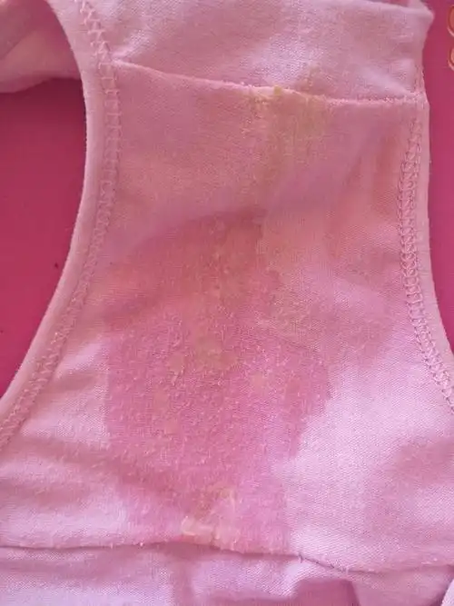 白带这样,是什么毛病 有图慎入