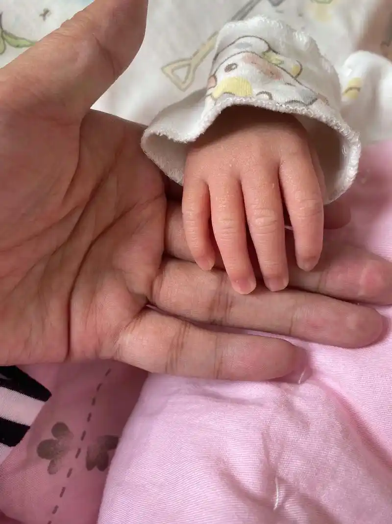 多漂亮干净的小手啊,当时做四维告诉我儿子手有问题,连着在医院 - 抖