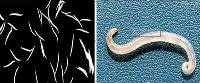 深夜,5岁女童下体排异物就诊!