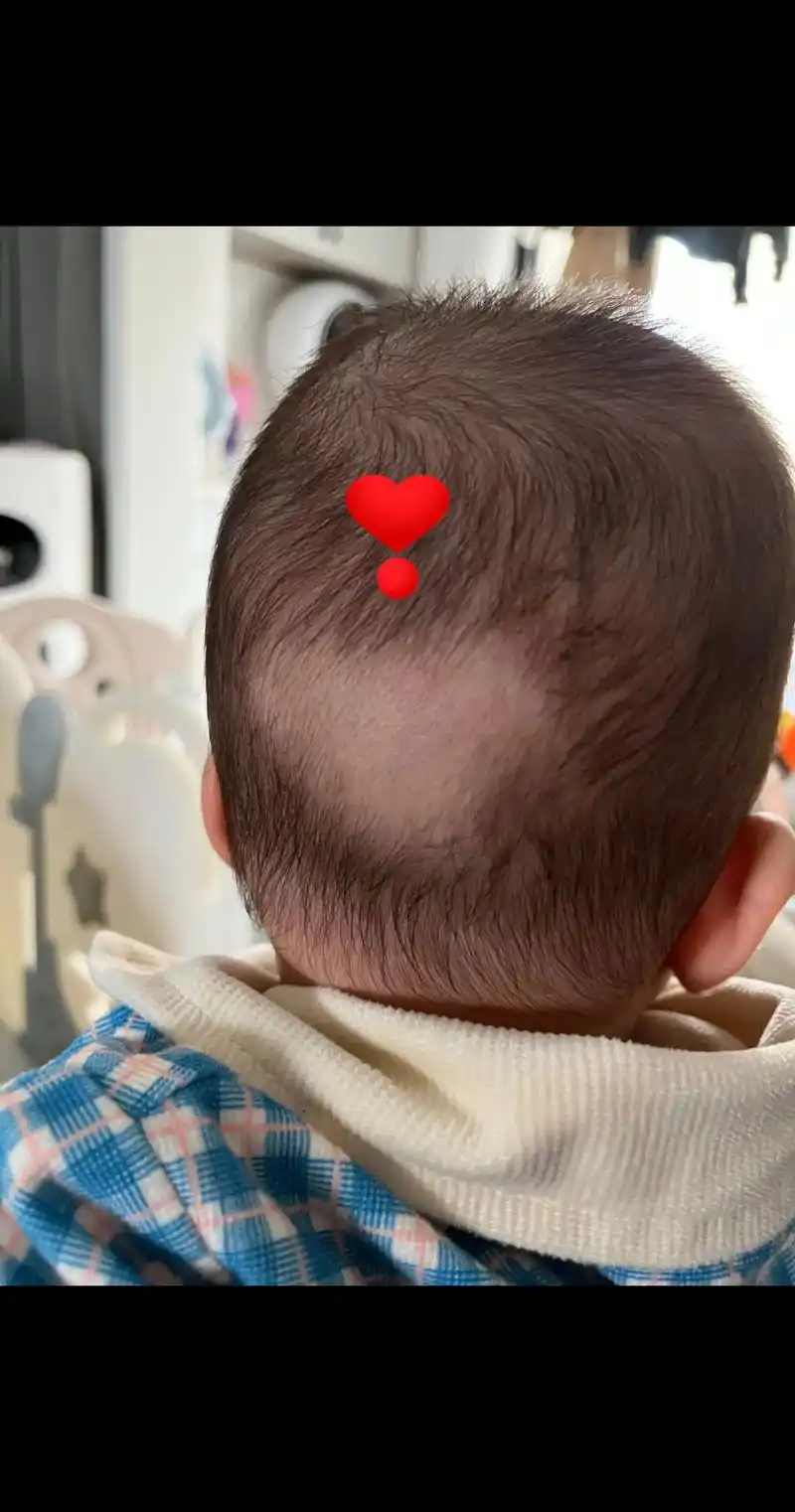 泡泡连枕秃都这么地有爱,你家宝宝的又是什么形状?