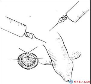 男子汉,要出"头"