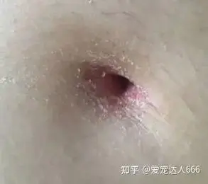 肚脐周围痒怎么办? - 知乎