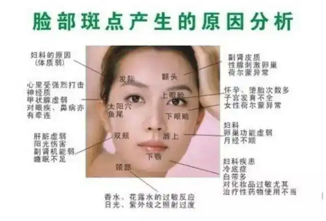 女人脸上长斑当心是妇科疾病