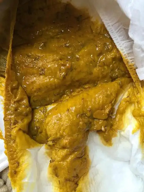 图片影响食欲慎入宝宝吃了香蕉不消化大便出现褐色细丝