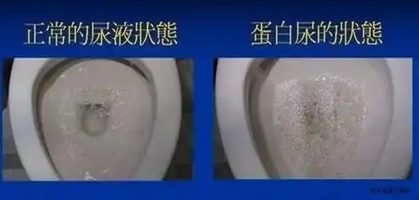 温馨提醒如果发现尿液的颜色,气味都与平常不同,并且已经持续了一段